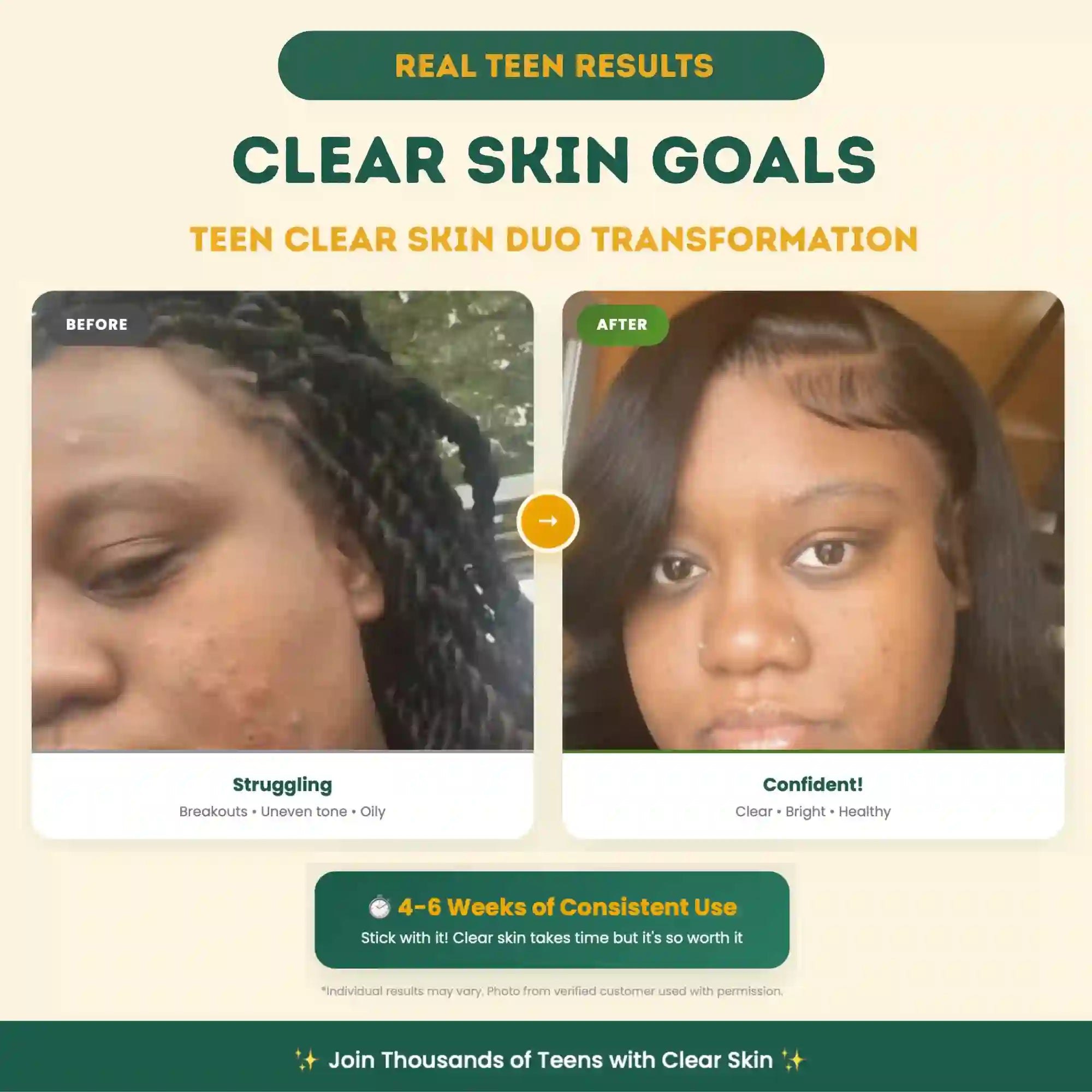 Teen Clear Skin Duo